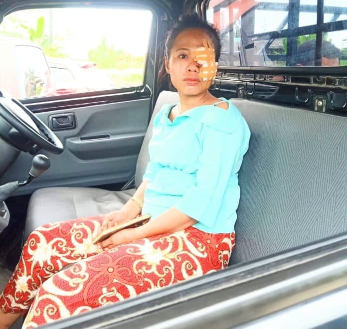 cekcok_di_warung_tuak_batu_bara_wajah_pelayan_terluka_dilempar_gelas