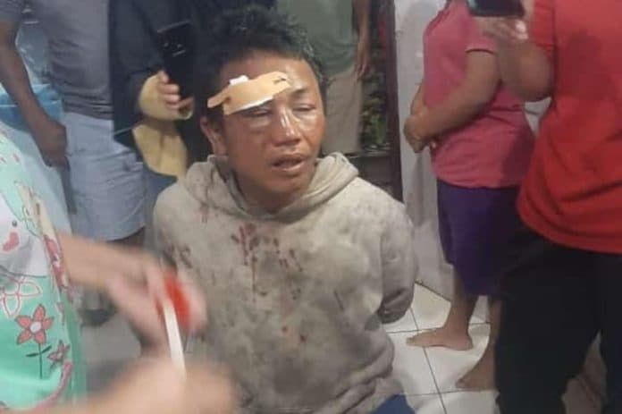 diduga_hendak_culik_anak_anak_seorang_pria_gelandangan_dihakimi_massa_di_siantar