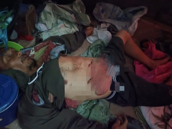 diduga_korban_pembunuhan_warga_silimakuta_simalungun_tewas_mengenaskan