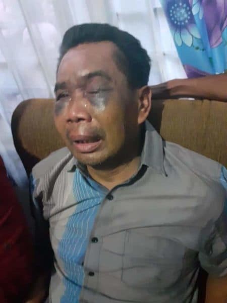dijadikan_saksi_kuli_bangunan_ini_disiksa_di_polsek_percut_sei_tuan