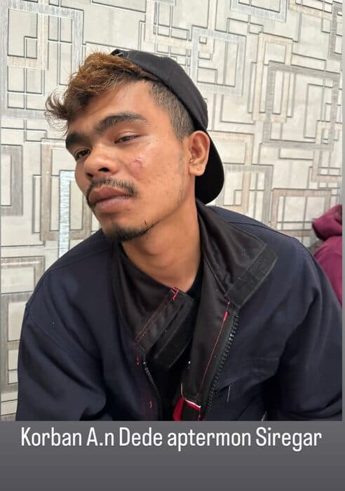 dikeroyok_rombongan_paslon_4_korban_melapor_ke_polres_taput