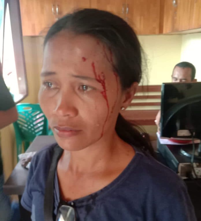 dipukul_dengan_gelas_hingga_berdarah_irt_di_siantar_lapor_polisi