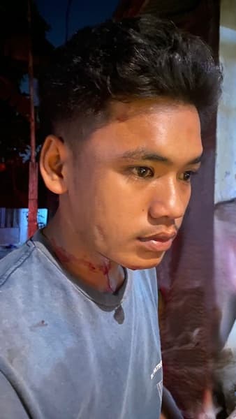 disabet_pakai_pisau_telinga_reza_warga_helvetia_nyaris_putus