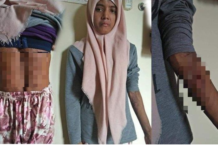 disiram_air_panas_dan_tak_makan_tki_disiksa_majikan_di_malaysia