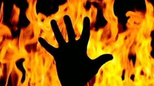 dituduh_curi_ikan_teri_bocah_di_belawan_disiram_bensin_dan_terbakar_hingga_80