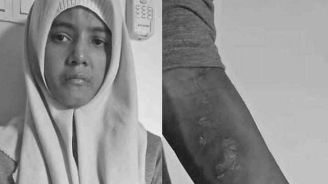 dubes_malaysia_dipanggil_terkait_penyiksaan_tki