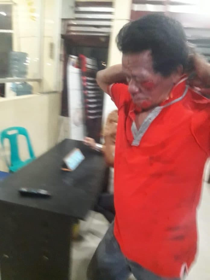 duh_juru_parkir_babak_belur_cuma_karena_menegur_pengendara