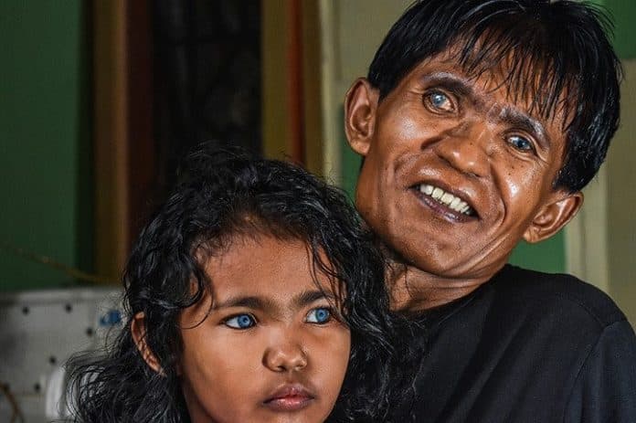 eksotik_fenomena_anak_bermata_biru_pekanbaru