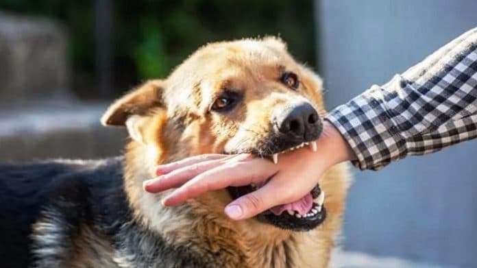 empat_warga_meninggal_ikuti_petunjuk_dinkes_simalungun_jika_digigit_anjing