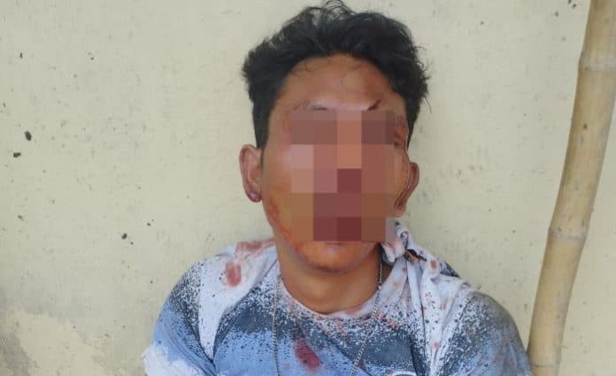hendak_larikan_motor_pekerja_anak_helvetia_dibonyok_warga