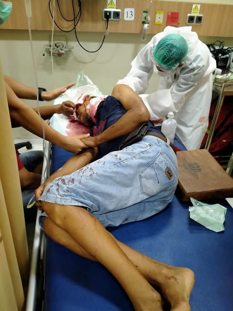 hendak_tangkap_dpo_personil_satreskrim_polres_belawan_dibacok