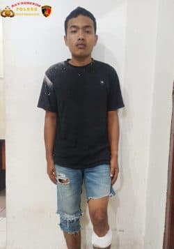 jambret_tas_wanita_kaki_warga_jalan_sriwijaya_siantar_ini_ditembak