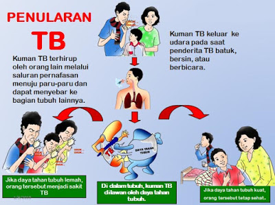 januari_juni_2020_725_kasus_tbc_ditemukan_di_simalungun