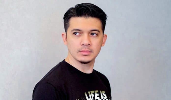 jatuh_dari_kuda_tangan_irwansyah_masih_gunakan_pen