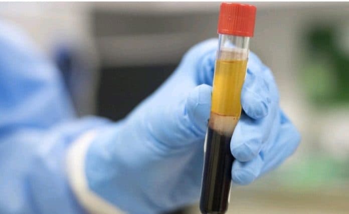 kabar_baik_pasien_pertama_di_india_gunakan_plasma_darah_membaik