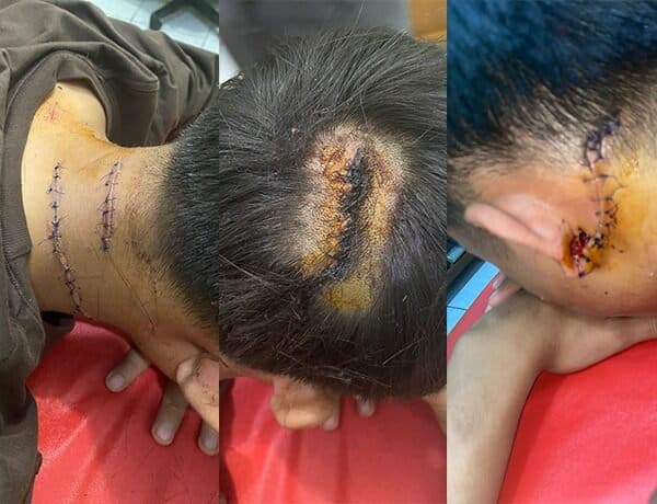 kasus_penganiayaan_warga_helvetia_korban_terus_terima_ancaman