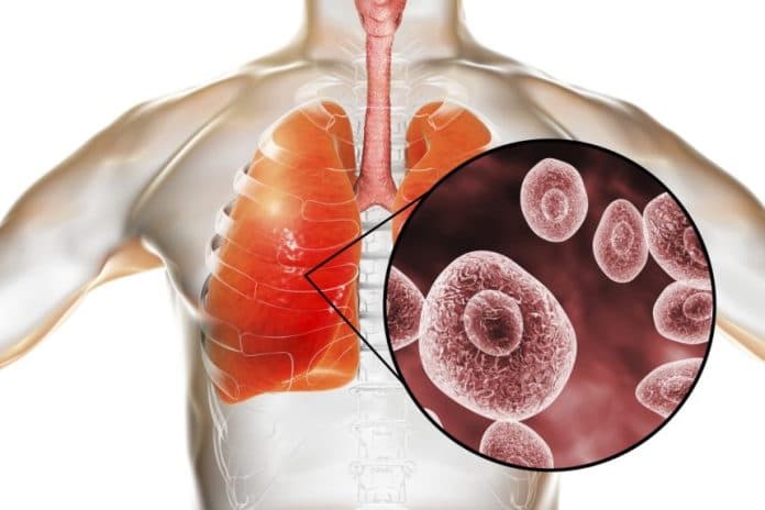 kasus_pneumonia_misterius_mewabah_di_china_menkes_jangan_khawatir_bukan_patogen_baru