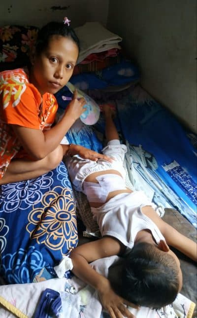 kawanan_monyet_masuk_ke_pemukiman_warga_di_kerasaan_balita_digigit_hingga_alami_luka_42_jahitan