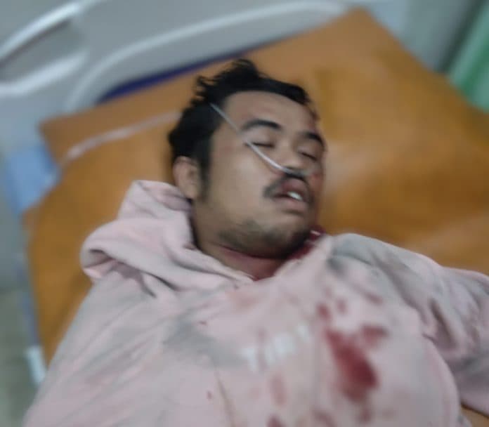 kejar_maling_sepeda_motor_pria_22_tahun_tak_sadarkan_diri