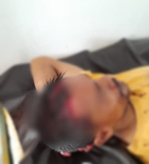 kepala_seorang_warga_dairi_koyak_dihantam_odgj_pakai_batu