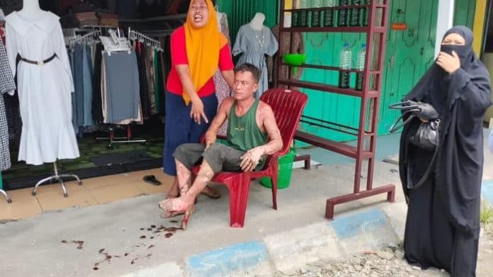kios_bbm_eceran_di_lubuk_pakam_terbakar_tubuh_pemiliknya_melepuh