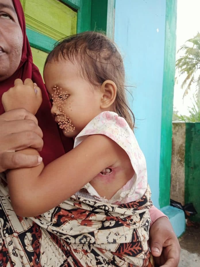 kisah_pilu_bocah_penderita_infeksi_tak_bisa_berobat_karena_himpitan_ekonomi