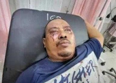 knpi_tanjungbalai_minta_polres_usut_pelaku_penganiaya_kadernya