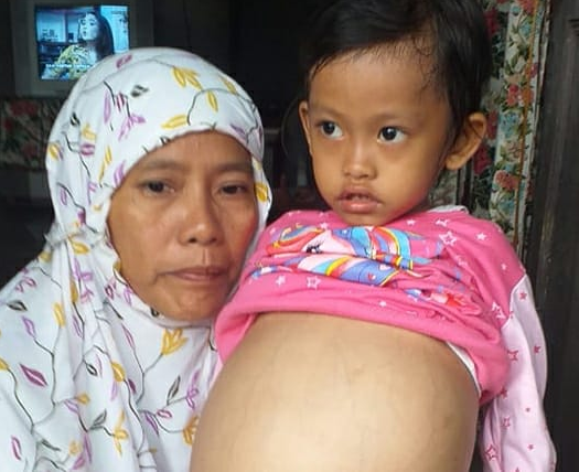 komjen_pol_agus_andrianto_dan_pujakesuma_sumut_bantu_bocah_penderita_kanker_di_tanjung_morawa