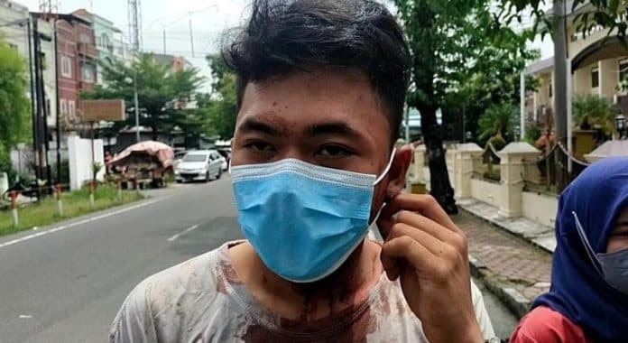 kondisi_berlumuran_darah_mahasiswa_ini_ngadu_ke_polrestabes_medan