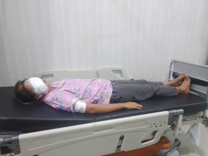 lihat_berboncengan_dengan_lelaki_lain_mantan_residivis_sayat_wajah_kekasihnya