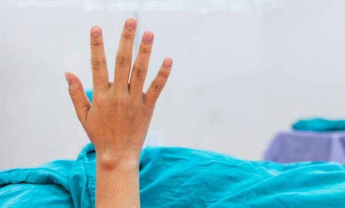 lima_bahan_alami_untuk_melawan_lipoma_bisa_dibuat_sendiri_di_rumah