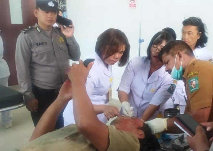 luka_di_kepala_korban_penembakan_di_tiga_runggu_sedang_duduk_bersama_warga