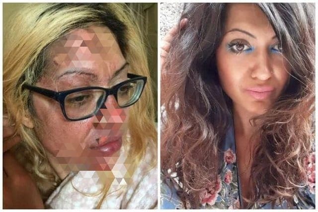 masak_telur_ala_tiktok_buat_muka_wanita_ini_terbakar