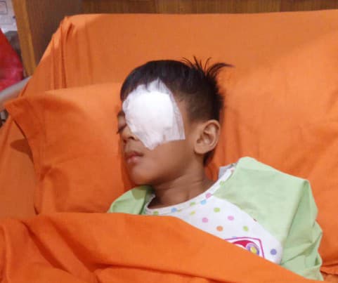 mata_anak_sd_tertancap_pulpem_teman_kelasnya_guru_tak_peduli