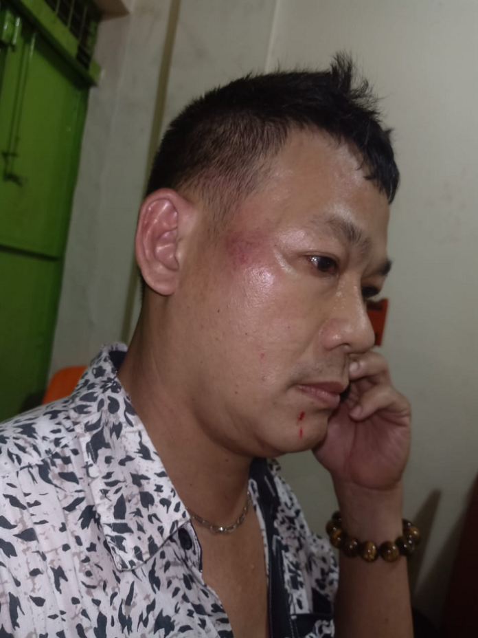mengaku_dianiaya_preman_warga_medan_denai_lapor_polisi