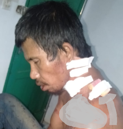 ngerih_adik_kritis_ditikam_abang_kandung_7_liang_di_dairi