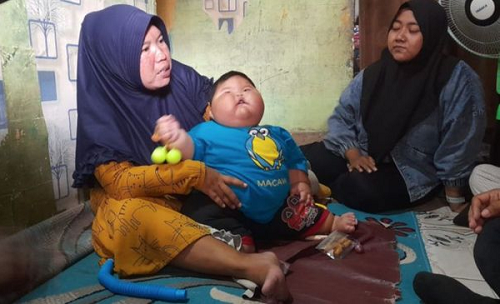 obesitas_bayi_16_bulan_berbobot_27_kg_asal_bekasi_dirujuk_ke_rscm