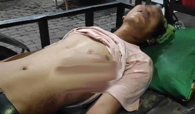 pak_ogah_diduga_dianiaya_sejumlah_oknum_polisi_di_jalan_sm_raja_medan