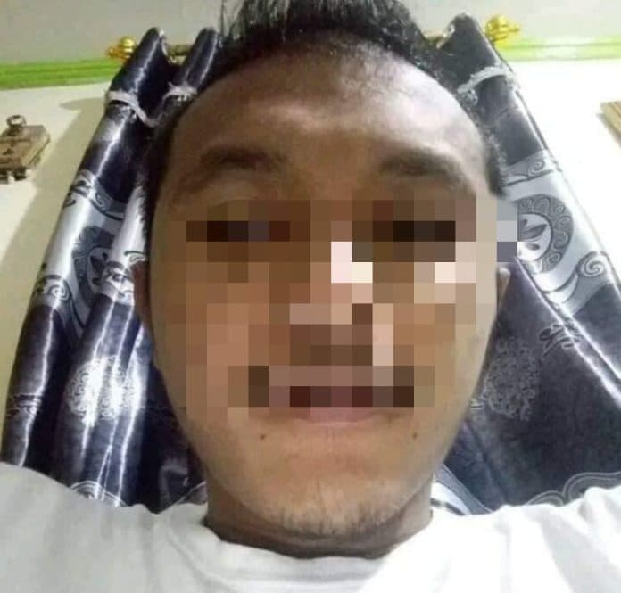 pelaku_cabul_bocah_5_tahun_di_pematangsiantar_belum_ditangkap