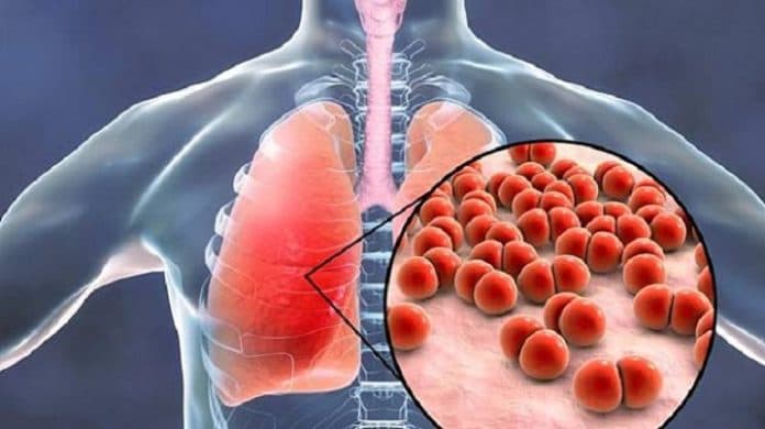 pemkab_simalungun_terbitkan_se_waspada_penyakit_mycoplasma_pneumonia