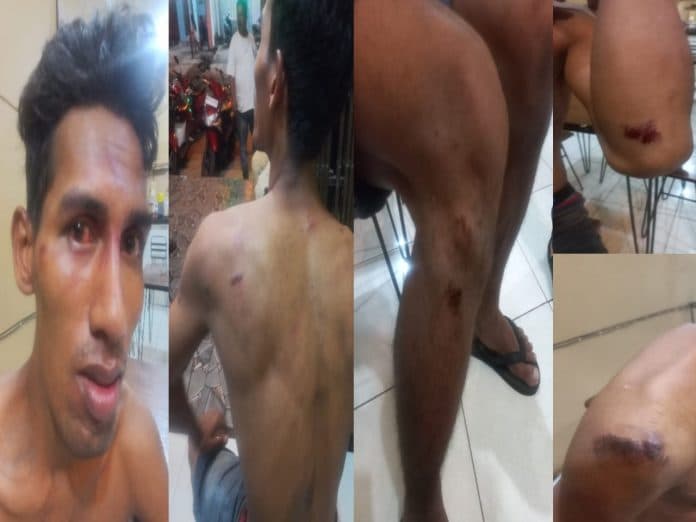 pemuda_di_belawan_dikeroyok_sekelompok_orang_hingga_babak_belur