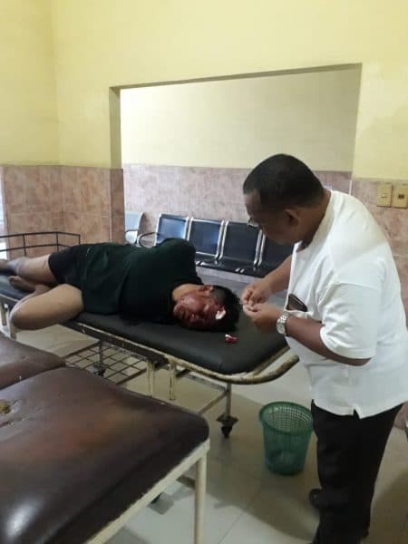 pencuri_honda_beat_dimassa_warga_tanjung_morawa