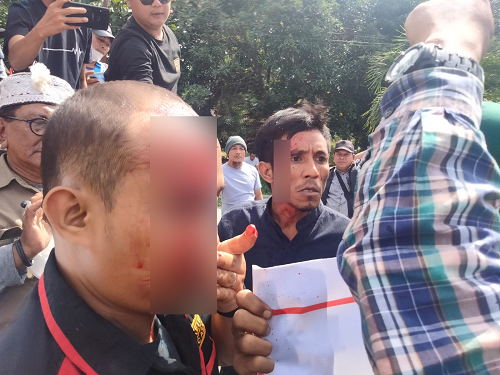 pendemo_terluka_akibat_pecahkan_gelas_ke_kepala_saat_demo_di_kejari_asahan