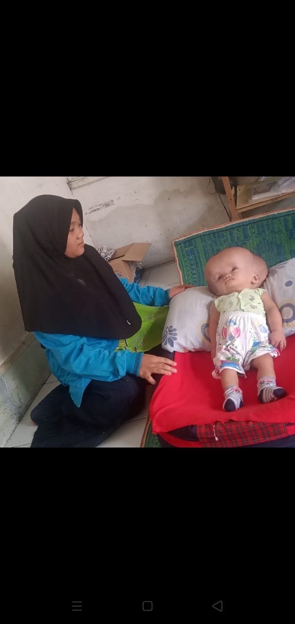 pengemudi_ojek_galang_dana_untuk_bayi_penderita_hydrocephalus