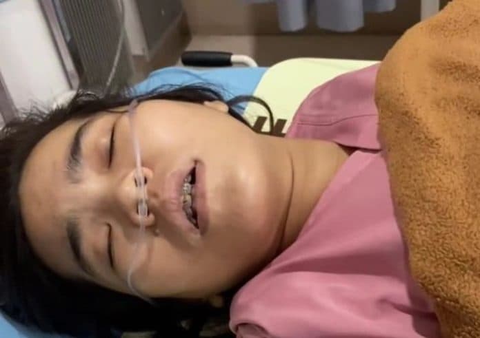 pengendara_nmax_yang_ditabrak_mercy_g_class_di_medan_alami_pendarahan_otak
