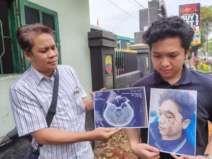 polrestabes_medan_selidiki_kasus_penganiayaan_mahasiswa_uisu_yang_ngaku_dihajar_taruna_akmil