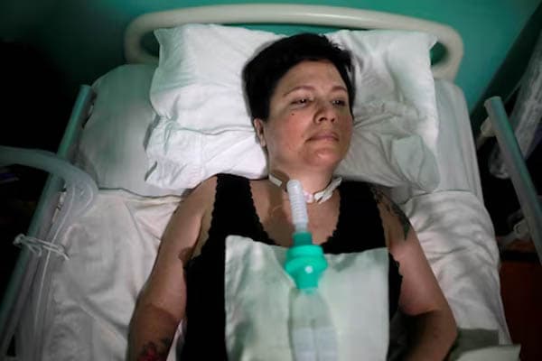 psikolog_ana_estrada_meninggal_setelah_jalani_euthanasia_pertama_di_peru