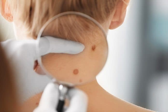 radiasi_gadget_picu_kanker_kulit_pada_anak_mitos_atau_fakta
