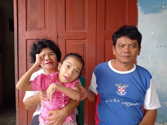 remaja_cantik_di_siantar_lumpuh_menahun_butuh_uluran_susanti_dan_dermawan
