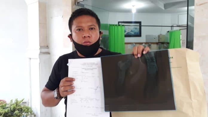 selamat_dari_tabrakan_maut_yang_telan_5_korban_jiwa_ini_kesaksian_sepri_saragih